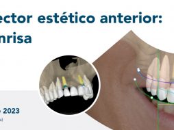 Masterclass Antonio Longo ES