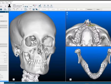 Virtual Articulator